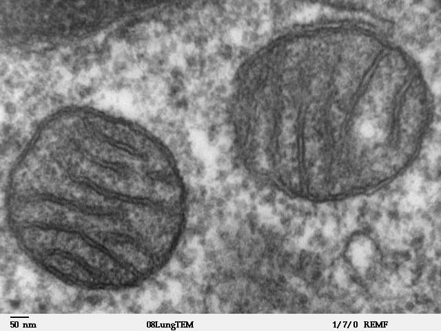 Electron microscope image in grey tones of two oval mitochondria in lung tissue, each with an outer membrane and folded inner membranes.