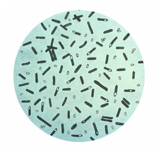 A microscope photograph of rod-shaped Clostridium botulinum bacteria stained purple.