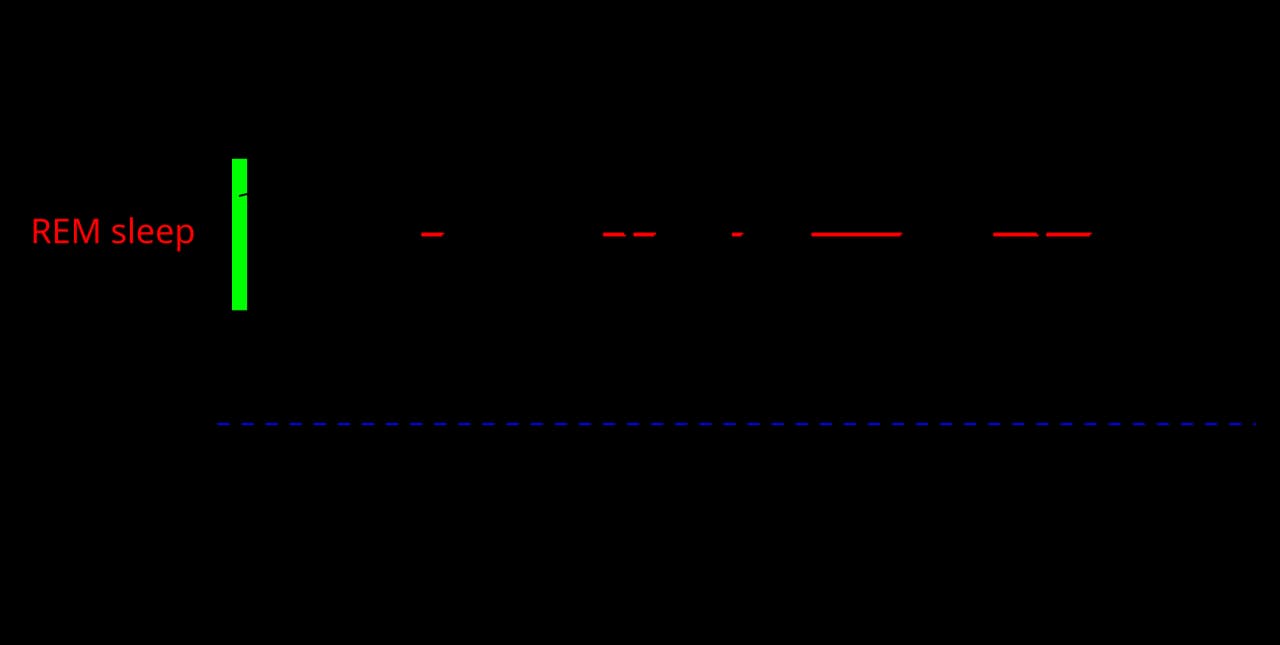 Hypnogram: a stepped line showing a night's sleep from midnight to 6:30 am, dropping from waking through stages 1 to 3 and rising into REM several times.