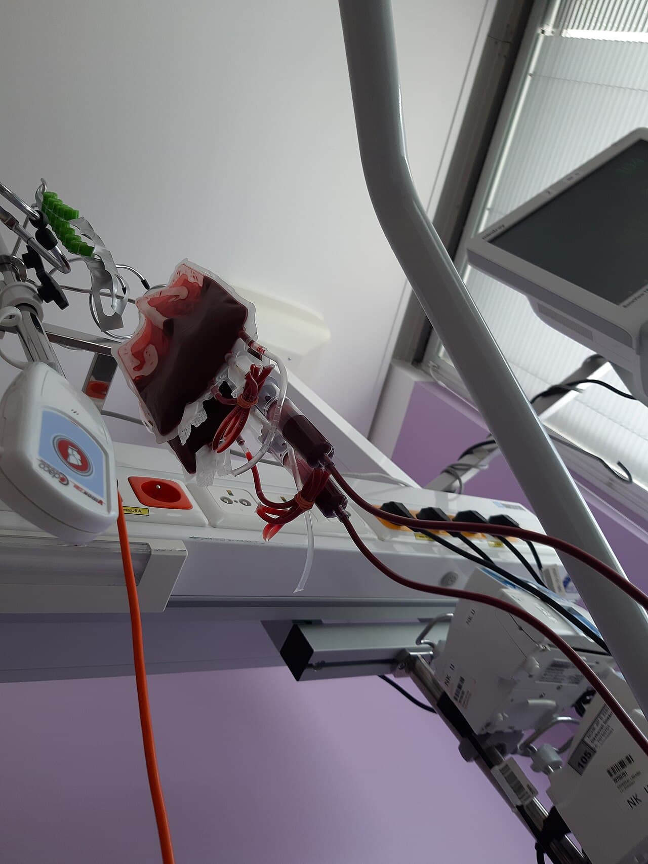 A bag of stored blood for transfusion